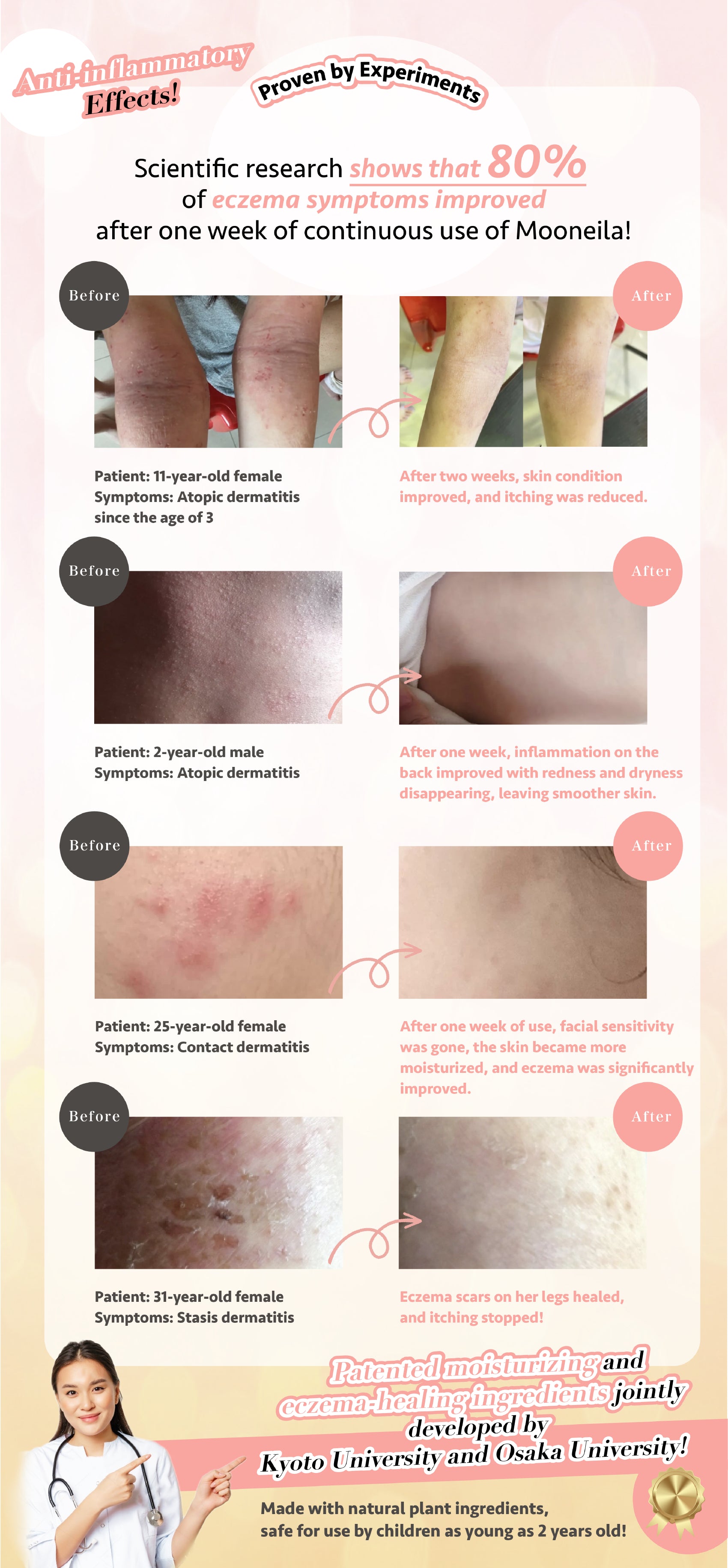 Anti-inflammatory effects
