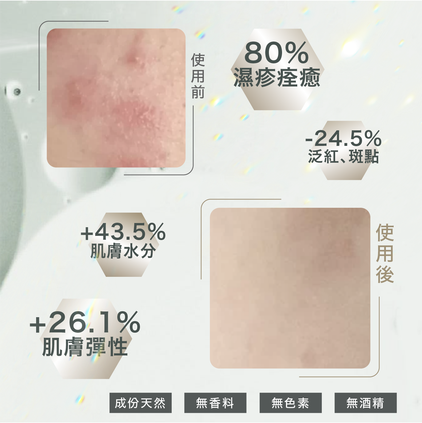 Mooneila M1天然藍藻精華是濕疹、敏感肌的救星