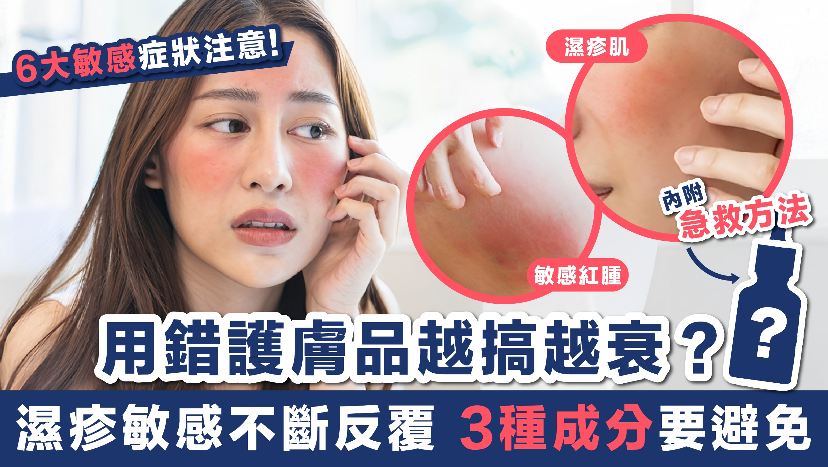 6大敏感症狀要注意